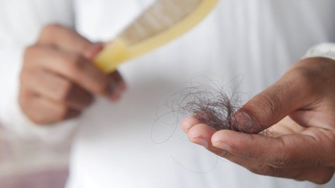  ¿Cómo evitar la caída del pelo?
 