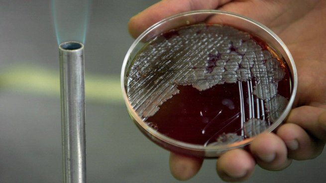  Alerta mundial por brote de ánthrax que ya se cobró una vida
 