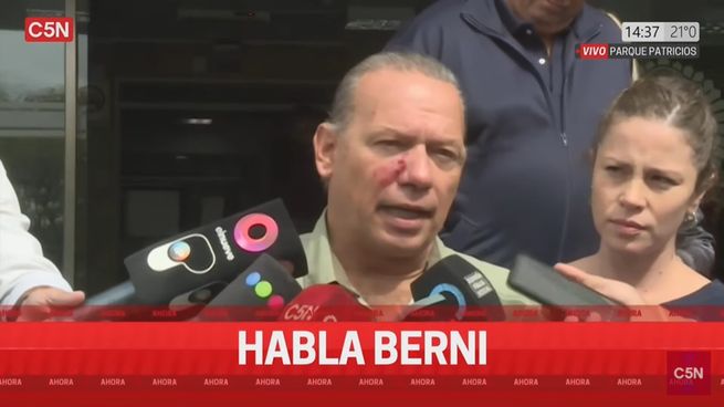  Habló Berni, tras la agresión: 